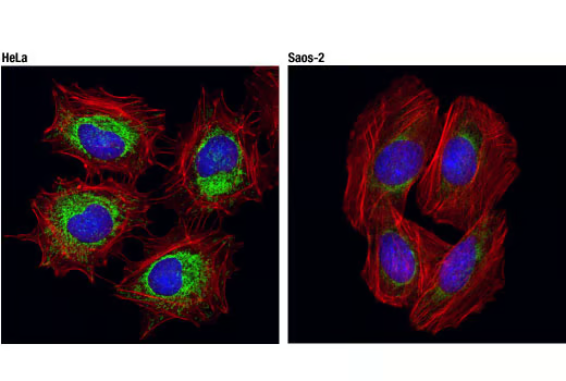 抗線粒體20 kDa外膜蛋白兔單抗,Tom20 (D8T4N) Rabbit mAb
