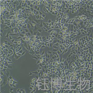 A2780（人卵巢癌細(xì)胞）YB-71013HC
