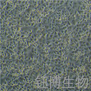 AGS（人胃腺癌細(xì)胞）YB-71022HC