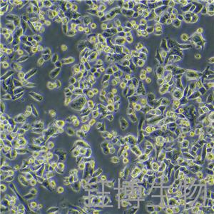 AsPC-1（人轉(zhuǎn)移胰腺腺癌細胞）YB-71027HC