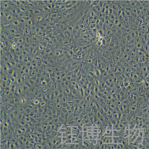 A549/Tax（人肺腺癌紫杉醇耐藥性細(xì)胞）YB-71585HC