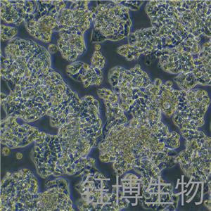 Hep-G2/2.2.15（人肝癌細胞）YB-71594HC