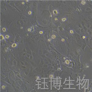 HPAF-II（人胰腺癌細(xì)胞）YB-71611HC