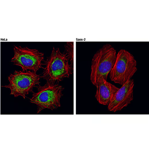 抗線粒體20 kDa外膜蛋白兔單抗,Tom20 (D8T4N) Rabbit mAb