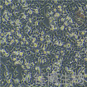 BIU-87（人膀胱癌細(xì)胞）YB-71035HC