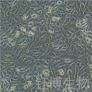 BT-549（人乳腺管癌細胞）YB-71041HC