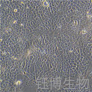 BxPC-3（人原位胰腺腺癌細胞）YB-71042HC