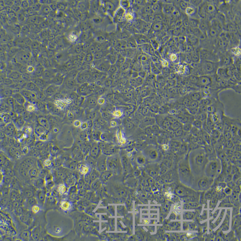 HT-3（人子宮頸癌細(xì)胞）YB-71630HC,HT-3