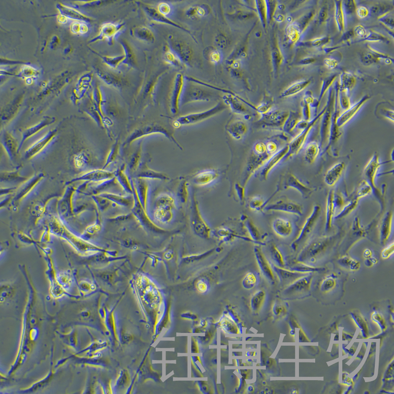 MDA-MB-231/GFP（人乳腺癌細(xì)胞（綠色熒光蛋白標(biāo)記））YB-71642HC,MDA-MB-231/GFP