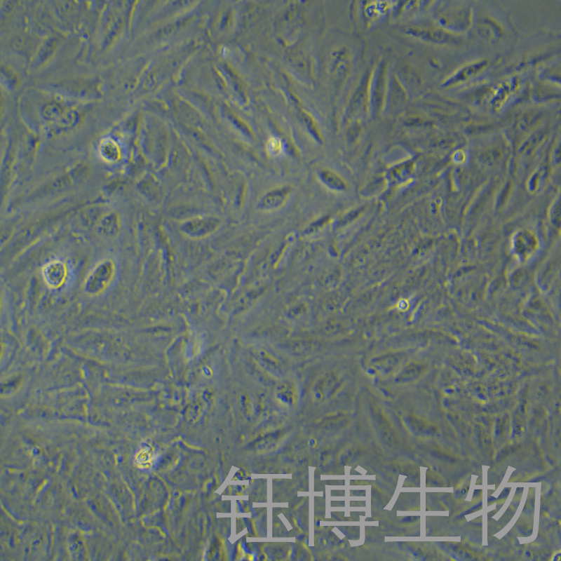TCCSUP（人膀胱癌細(xì)胞）YB-71628HC,TCCSUP