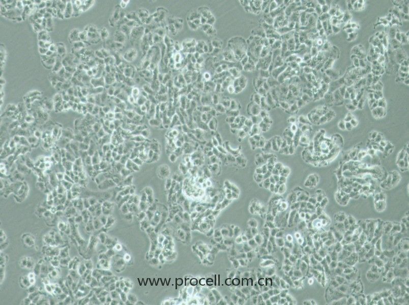 QGP-1細(xì)胞 (人胰腺癌細(xì)胞) (STR鑒定正確)CL-0977,QGP-1 Cells Line  ;QGP 1;QGP1