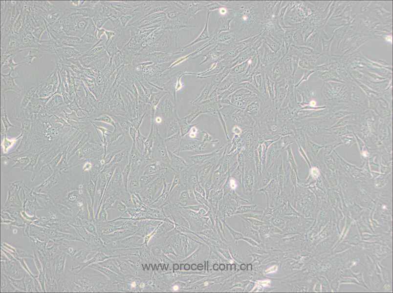 3T3-Swiss albino細(xì)胞 (小鼠胚胎成纖維細(xì)胞) (STR鑒定正確)CL-0536,3T3-Swiss albino Cells Line;3T3 Swiss Albino;3T3;Swiss-3T3;Swiss 3T3;Swiss3T3