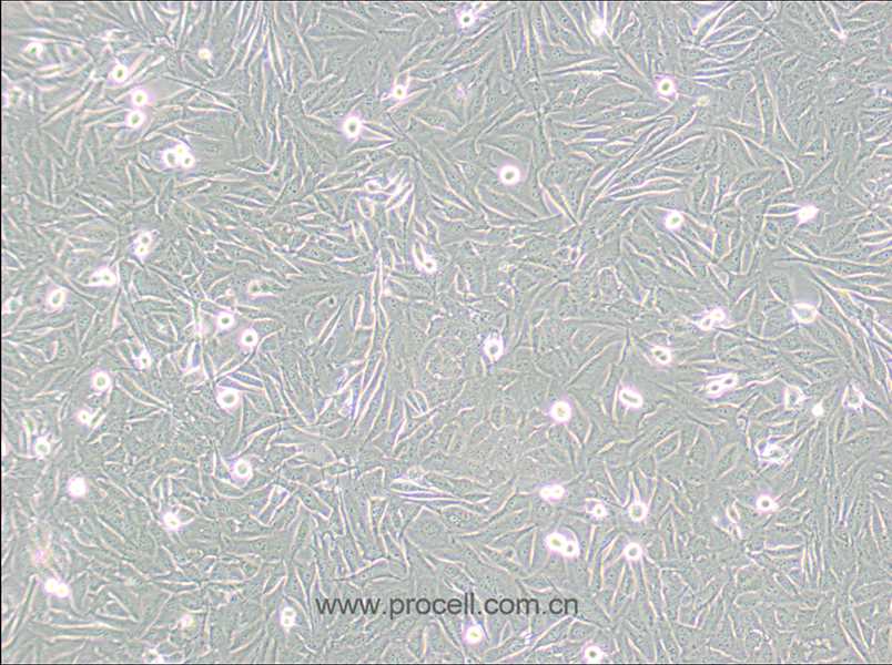 A2058細(xì)胞 (人皮膚癌細(xì)胞) (STR鑒定正確)CL-0652,A2058 Cells Line;A2058