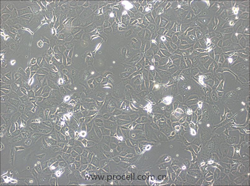 NCI-H1693細(xì)胞 (人肺腺癌細(xì)胞) (STR鑒定正確)CL-0876,NCI-H1693 Cells Line  ;H1693;H-1693;NCIH1693
