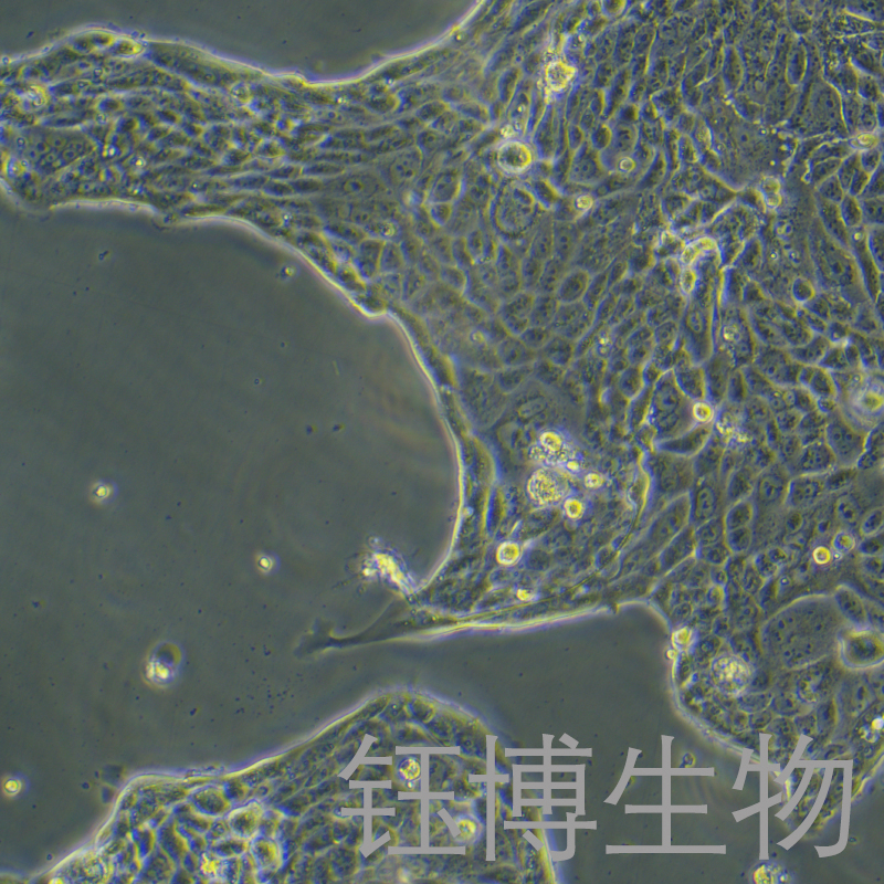Calu-3（人肺腺癌细胞(胸水) ）YB-71054HC,Calu-3