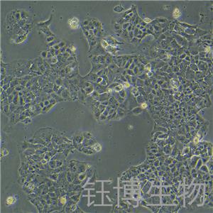 OV-90（人卵巢癌細(xì)胞）YB-71626HC