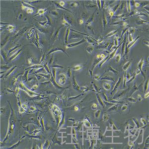 MDA-MB-231/GFP（人乳腺癌細(xì)胞（綠色熒光蛋白標(biāo)記））YB-71642HC,MDA-MB-231/GFP