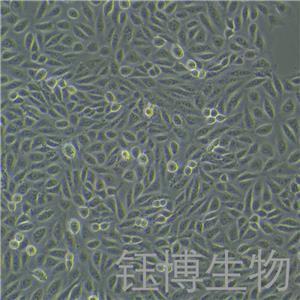 TPC-1（人甲狀腺癌細胞）YB-71643HC