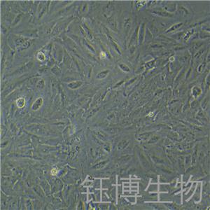 TCCSUP（人膀胱癌細(xì)胞）YB-71628HC,TCCSUP