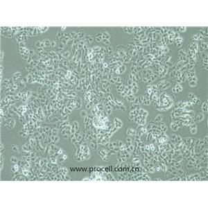 QGP-1細(xì)胞 (人胰腺癌細(xì)胞) (STR鑒定正確)CL-0977,QGP-1 Cells Line  ;QGP 1;QGP1