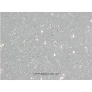 3T3-Swiss albino細(xì)胞 (小鼠胚胎成纖維細(xì)胞) (STR鑒定正確)CL-0536,3T3-Swiss albino Cells Line;3T3 Swiss Albino;3T3;Swiss-3T3;Swiss 3T3;Swiss3T3