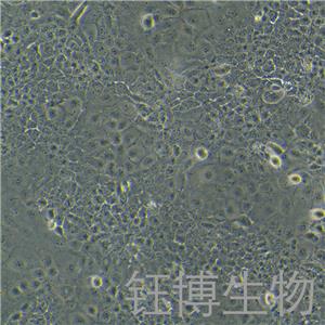Ca Ski（人宮頸癌腸轉(zhuǎn)移細(xì)胞/人宮頸癌上皮細(xì)胞）YB-71048HC