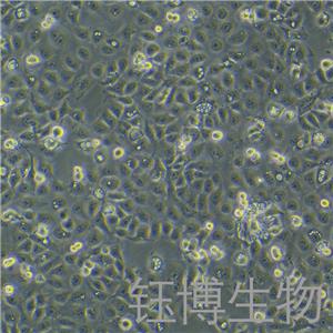 KYSE-150（人食管鱗癌細(xì)胞）YB-71638HC
