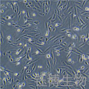 KTC-1（人甲狀腺癌細胞）YB-71649HC,KTC-1