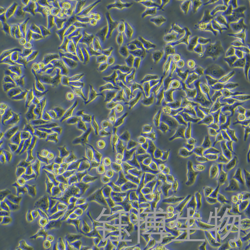 HCCLM3（人高轉(zhuǎn)移肝癌細(xì)胞）YB-71278HC,HCCLM3