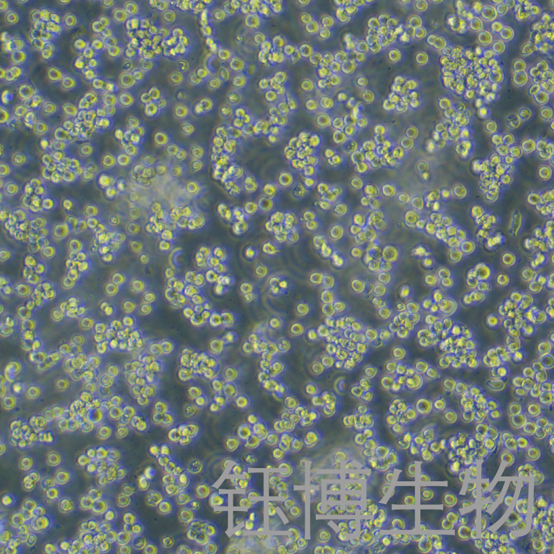 HEL（人红白细胞白血病细胞）YB-71280HC,HEL