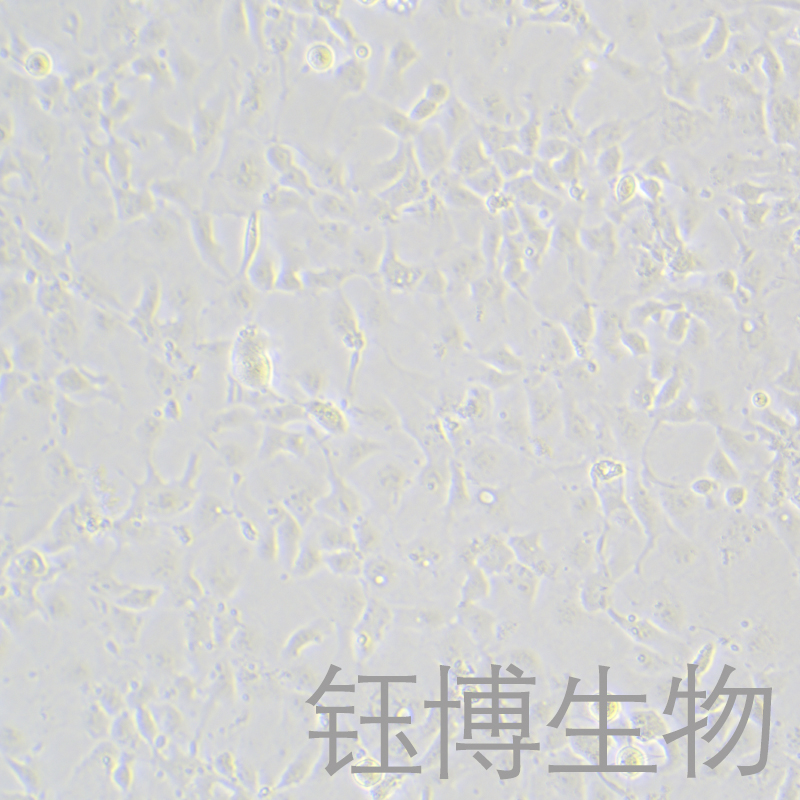 Hep 3B2.1-7（人肝癌细胞）YB-71102HC,Hep 3B2.1-7