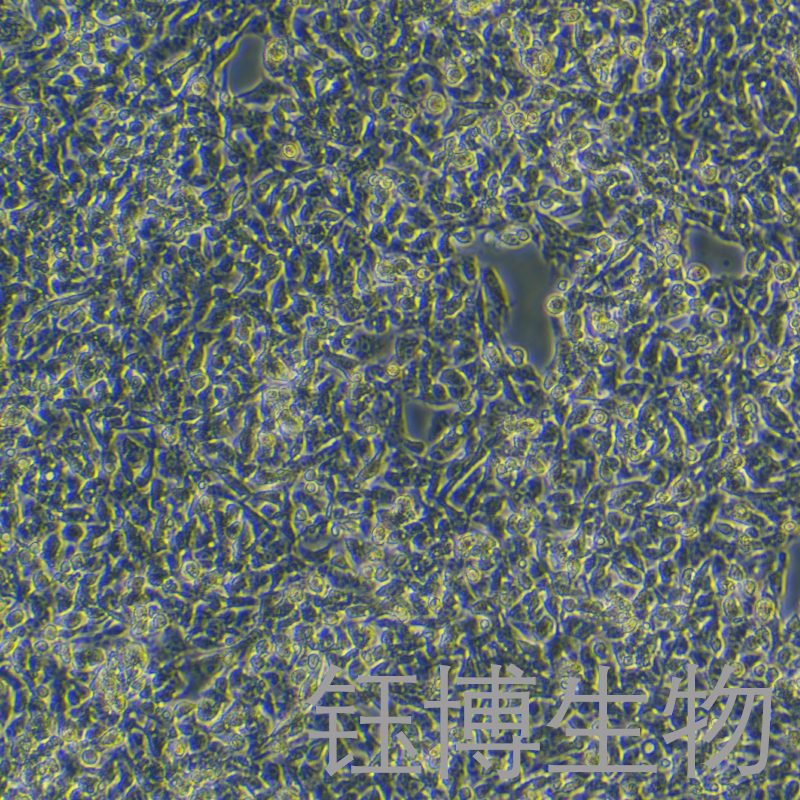 Hep G2（人肝癌细胞）YB-71103HC,Hep G2