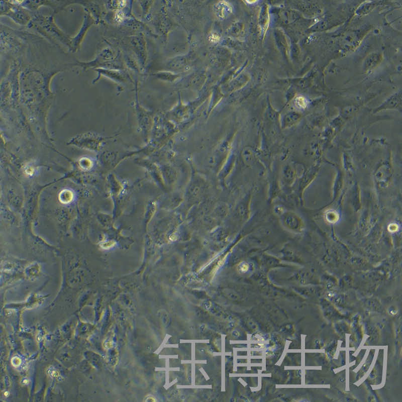 hFOB 1.19（人SV40转染成骨细胞）YB-71353HC,hFOB 1.19