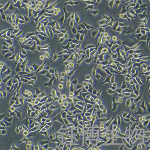 HCCLM3（人高轉(zhuǎn)移肝癌細(xì)胞）YB-71278HC,HCCLM3