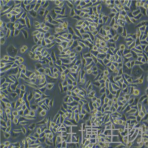 Hela（人宫颈癌细胞）YB-71101HC
