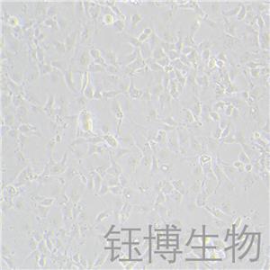 Hep 3B2.1-7（人肝癌细胞）YB-71102HC,Hep 3B2.1-7