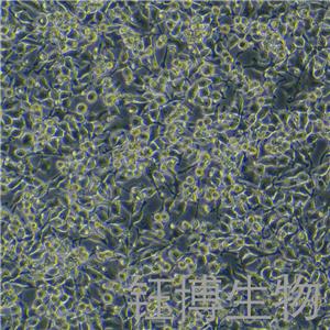 HO-8910（人卵巢癌细胞）YB-71113HC