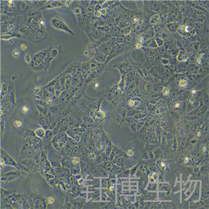 JEG-3（人絨毛膜癌細(xì)胞）YB-71127HC