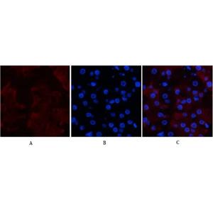 CD23 (3D1)鼠單克隆抗體,CD23 (3D1) Mouse Monoclonal Antibody