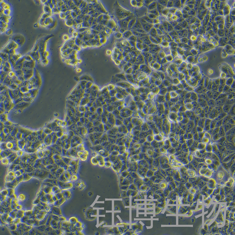 MCF7 [MCF-7]（人乳腺癌细胞）YB-71149HC,MCF7 [MCF-7]