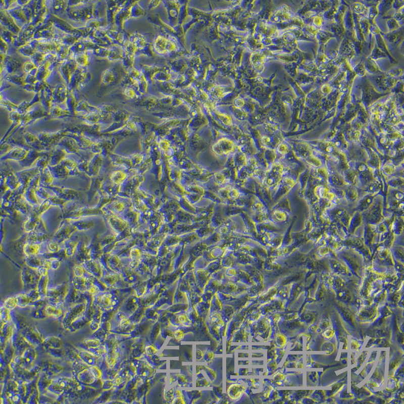 NCI-H1395（人肺腺癌细胞）YB-71275HC,NCI-H1395