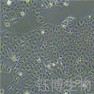 MKN-28（人胃癌高转移细胞）YB-71291HC