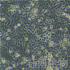 MuM-2B（人侵袭性脉络膜黑色素瘤细胞）YB-71293HC