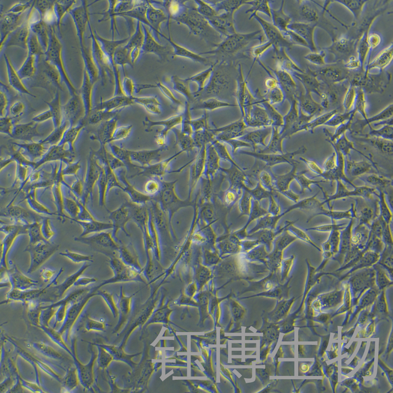 C127 [C-127]（小鼠乳腺肿瘤细胞）YB-72043MC,C127 [C-127]