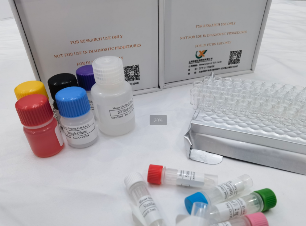 人神经胶质纤维酸性蛋白ELISA检测试剂盒,Human Glial Fibrillary Acidic Protein (GFAP) ELISA Kit