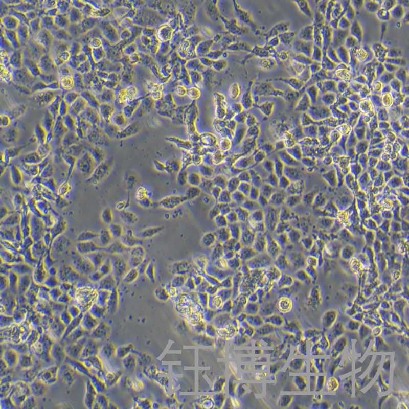 RL95-2（人子宫内膜癌细胞）YB-71197HC,RL95-2