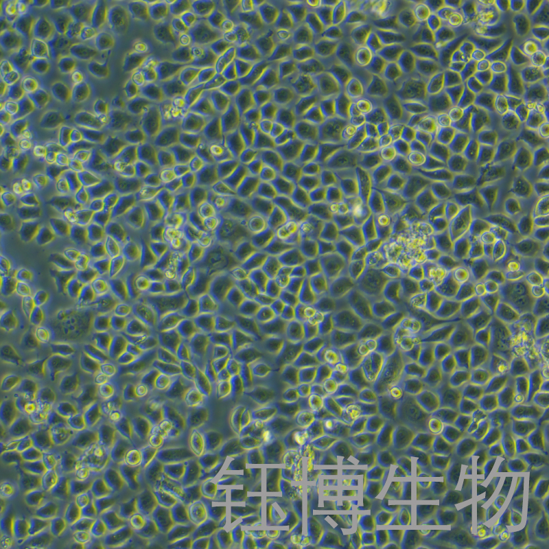 RWPE-1（人正常前列腺上皮细胞）YB-71200HC,RWPE-1