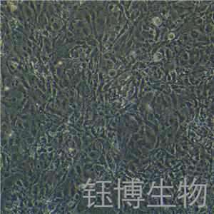 3T3-L1（小鼠胚胎成纖維細胞）YB-72006MC
