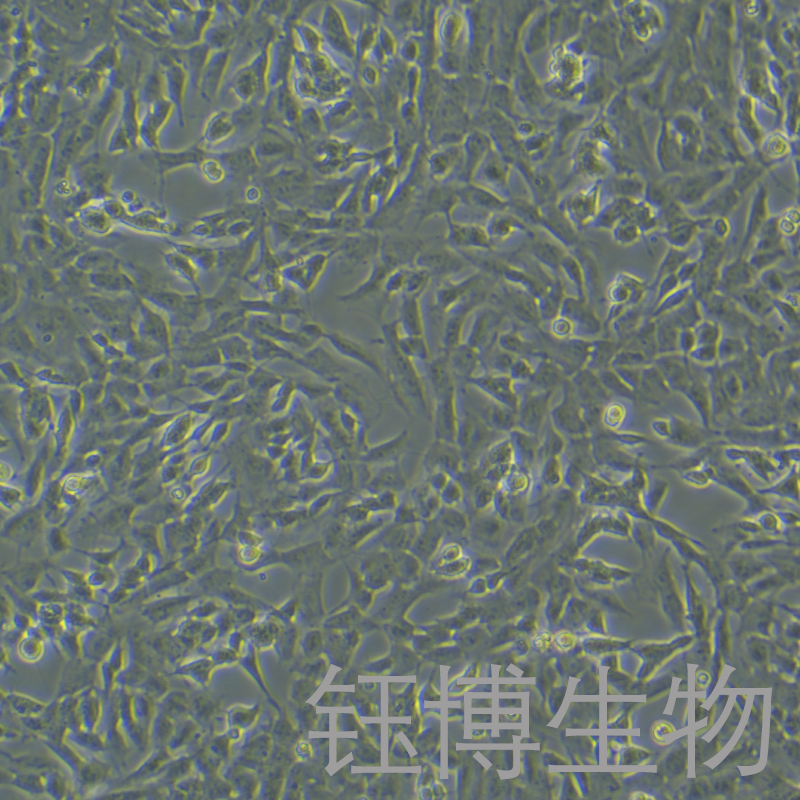 SH-SY5Y [SHSY-5Y]（人神经母细胞瘤细胞）YB-71208HC,SH-SY5Y [SHSY-5Y]