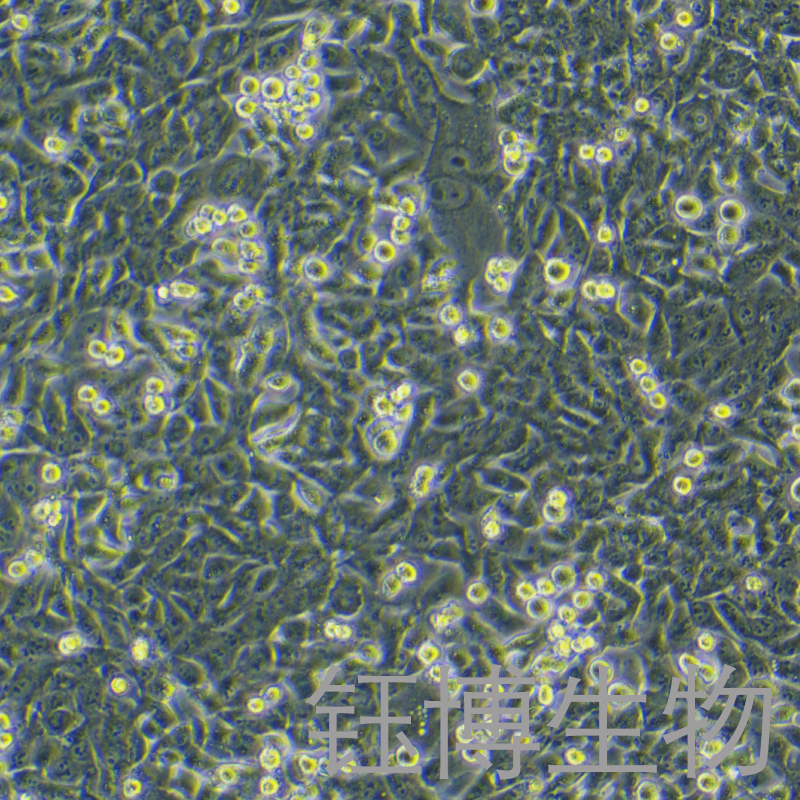 SK-Hep-1（人肝癌细胞）YB-71212HC,SK-Hep-1